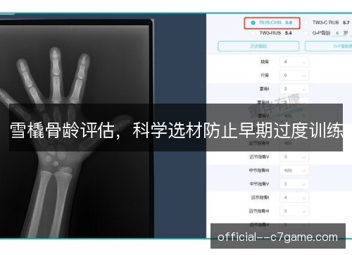 雪橇骨龄评估,科学选材防止早期过度训练 雪橇骨龄评估,科学选材防止早期过度训练